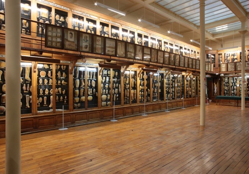 Musée des Moulages : le trésor macabre de Paris à découvrir d’urgence